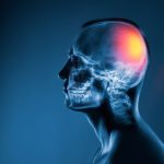 5 Tips Menghindari Cedera Tengkorak Saat Aktivitas Berat