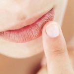 10 Tips Alami untuk Mengatasi Bibir Kering dan Pecah-Pecah