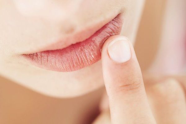 10 Tips Alami untuk Mengatasi Bibir Kering dan Pecah-Pecah 10 Tips Alami untuk Mengatasi Bibir Kering dan Pecah-Pecah