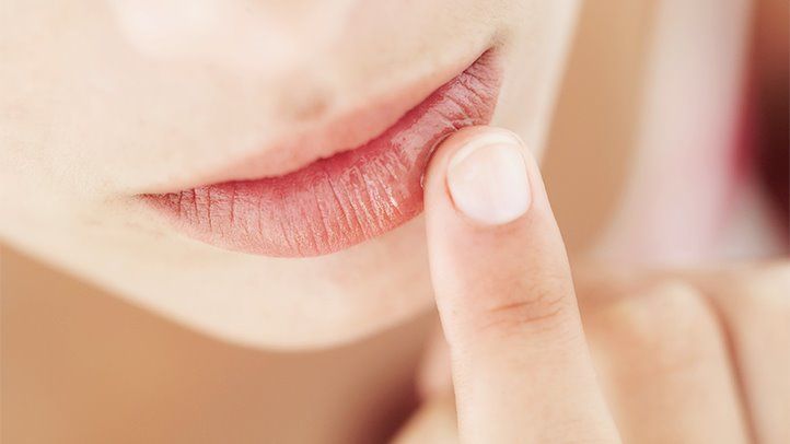 10 Tips Alami untuk Mengatasi Bibir Kering dan Pecah-Pecah