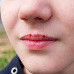 7 Tips Mencegah Bibir Kering Saat Cuaca Ekstrem