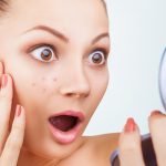 7 Tips Mencegah Jerawat Muncul Kembali di Wajah