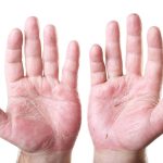 7 Tips Menghindari Kulit Kering di Telapak Tangan