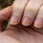 7 Tips Agar Kuku Tidak Mudah Menguning