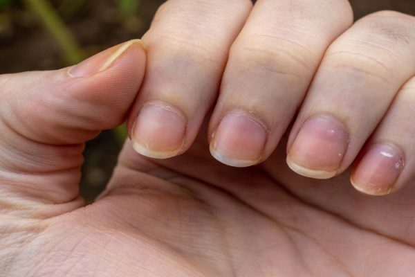 7 Tips Agar Kuku Tidak Mudah Menguning