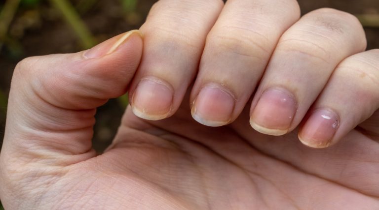 7 Tips Agar Kuku Tidak Mudah Menguning