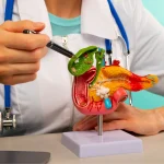 7 Tips Sederhana Merawat Kantong Empedu untuk Hidup Sehat