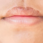 7 Tips Mengatasi Bibir Kering dan Pecah-Pecah Secara Alami