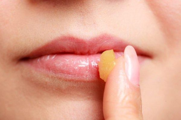 10 Tips Alami untuk Mengatasi Bibir Kering dan Pecah-pecah